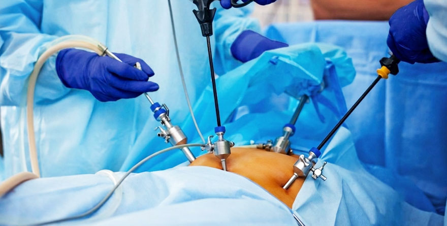 Laparoscopic Surgery
