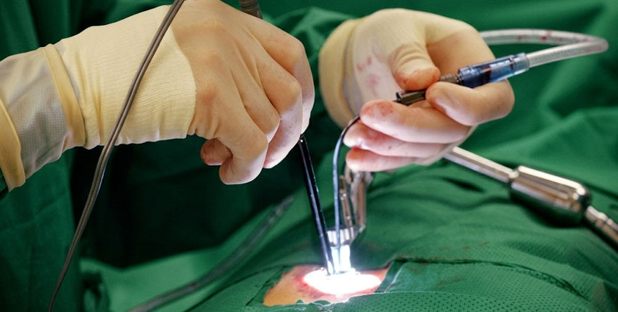 Minimally Invasive Surgery