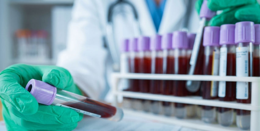 Laboratory Blood Tests