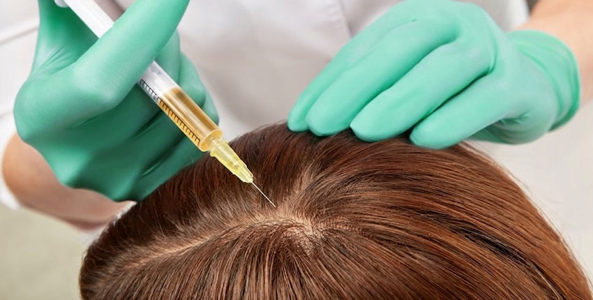 PRP Injections