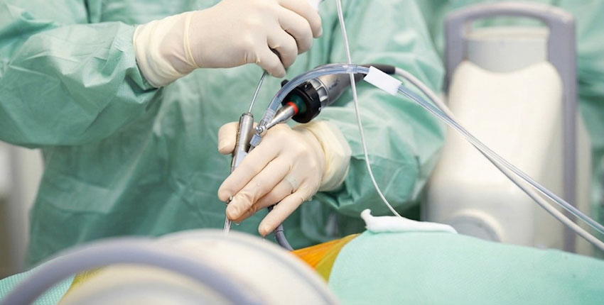 Endoscopic Joint Surgeries