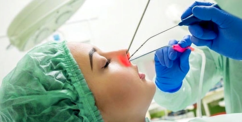 Endoscopic Nose Surgeries