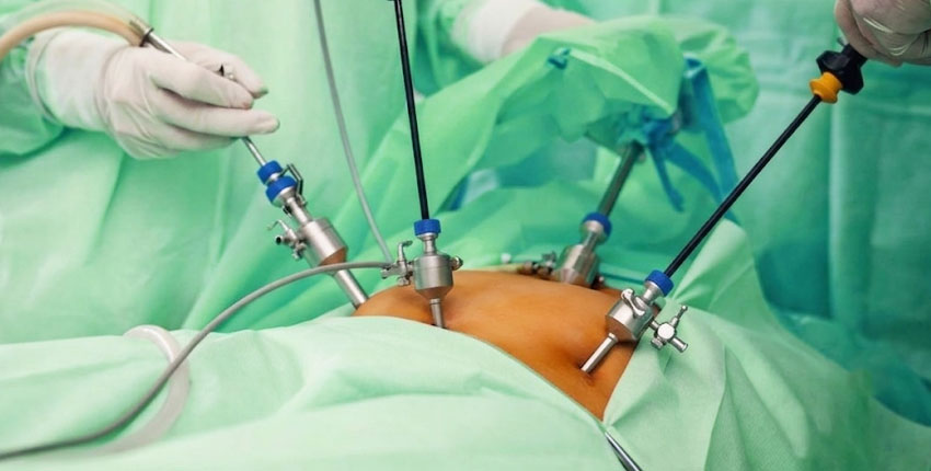 Gynaecological Procedures