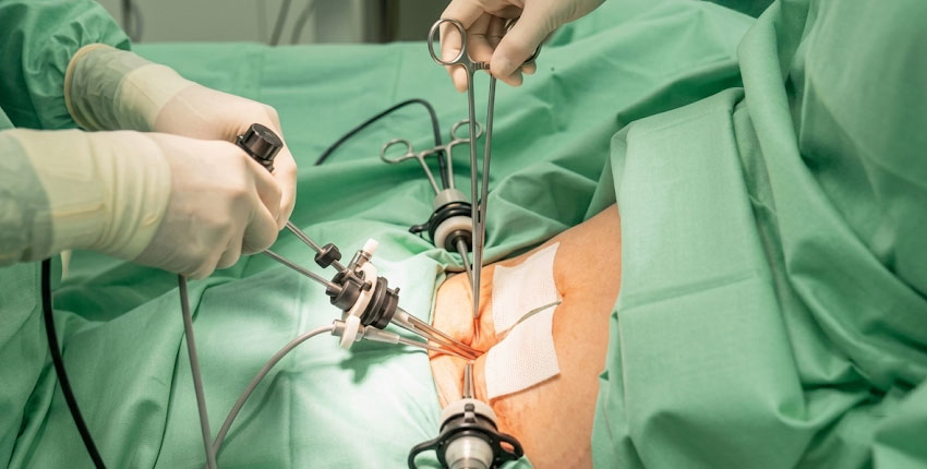 Hernia Repair