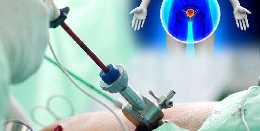 Urological Procedures