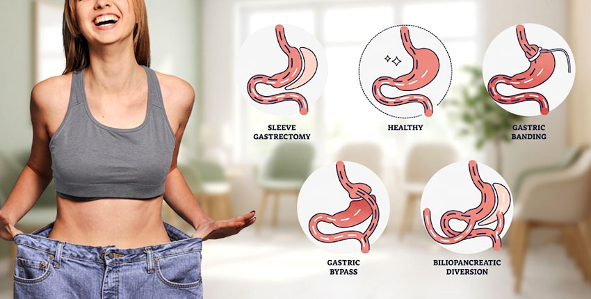 Weight Loss Surgery